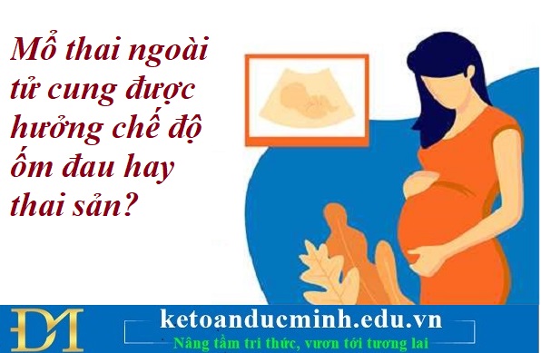 Mổ thai ngoài tử cung được hưởng chế độ ốm đau hay thai sản? Kế toán Đức Minh. Mổ thai ngoài tử cung được hưởng chế độ ốm đau hay thai sản? Kế toán Đức Minh.
